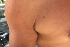 1996  16-1-18 rash