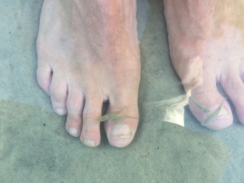 1651  27-12 Fish pedicure