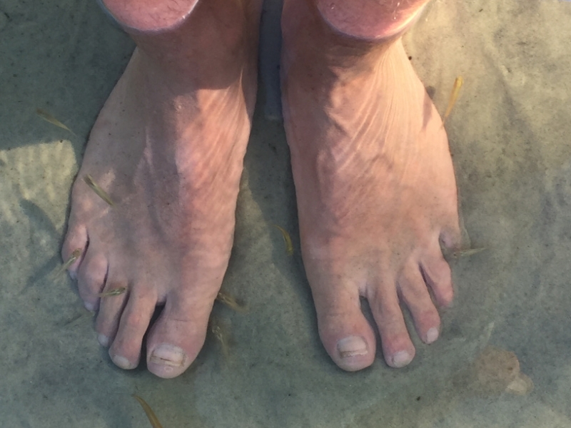 1652  27-12 Fish pedicure