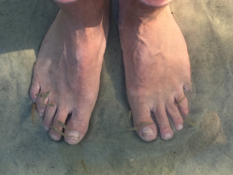 1653  27-12 Fish pedicure