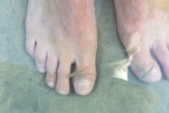 1651  27-12 Fish pedicure