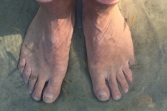 1652  27-12 Fish pedicure