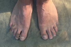 1653  27-12 Fish pedicure