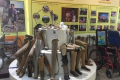 9119 24-6-19 prosthetics